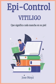 Paperback Vitiligo: ¿Que significa cada mancha? [Spanish] Book