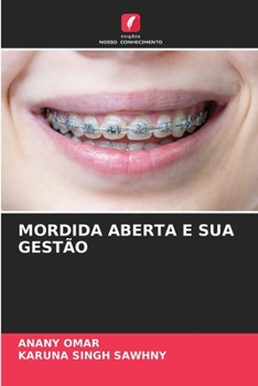 Paperback Mordida Aberta E Sua Gestão [Portuguese] Book