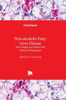Hardcover Non-alcoholic Fatty Liver Disease - New Insight and Glance Into Disease Pathogenesis Book