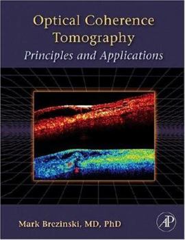 Hardcover Optical Coherence Tomography: Principles and Applications Book