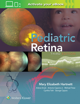 Paperback Pediatric Retina Book