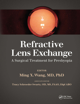 Hardcover Refractive Lens Exchange: A Surgical Treatment for Presbyopia Book