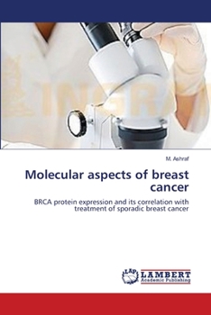 Paperback Molecular aspects of breast cancer Book