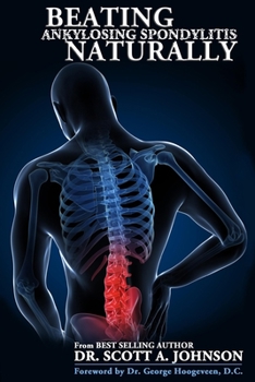 Paperback Beating Ankylosing Spondylitis Naturally Book
