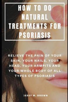 Paperback How to Do Natural Treatments for Psoriasis: Relieve the Pain of Your Skin, Your Nails, Your Head, Your Armpits and Your Whole Body of All Types of Pso Book