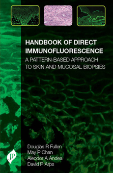 Hardcover Handbook of Direct Immunofluorescence: A Pattern-Based Approach to Skin and Mucosal Biopsies Book