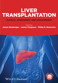 Hardcover Liver Transplantation Book