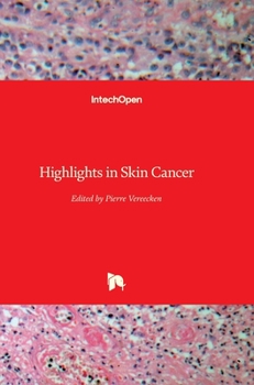 Hardcover Highlights in Skin Cancer Book