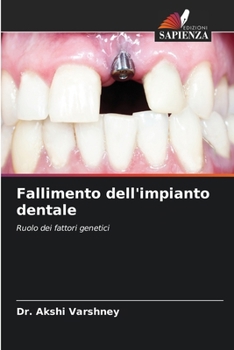 Fallimento dell'impianto dentale (Italian Edition)