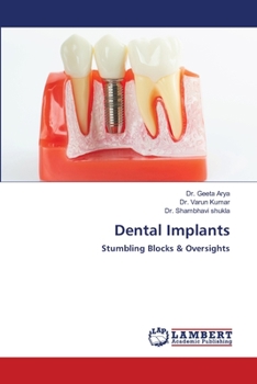 Paperback Dental Implants Book