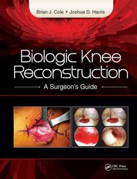 Hardcover Biologic Knee Reconstruction: A Surgeon's Guide Book
