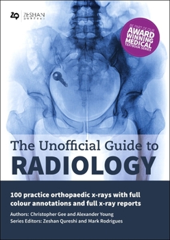 Paperback The Unofficial Guide to Radiology: 100 Practice Orthopaedic X Rays with Full Colour Annotations and Full X Ray Reports Book