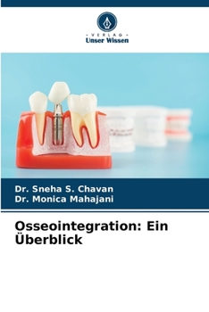 Osseointegration: Ein Überblick