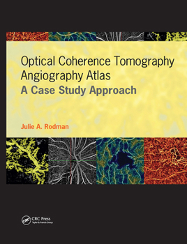Hardcover Optical Coherence Tomography Angiography Atlas: A Case Study Approach Book