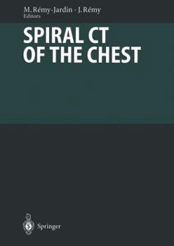 Paperback Spiral CT of the Chest Book