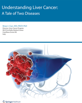 Paperback Understanding Liver Cancer: A Tale of Two Diseases Book