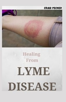 Paperback Healing From Lyme Disease: Medicine Guide to Diagnosing and Treating Tick-Borne Illness Book