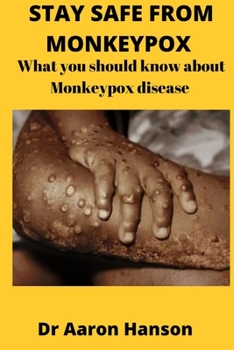 Paperback Stay Safe from Monkeypox: What You Should Know About Monkeypox Disease Book