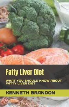 Paperback Fatty Liver Diet: What You Should Know about Fatty Liver Diet Book
