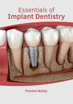 Hardcover Essentials of Implant Dentistry Book