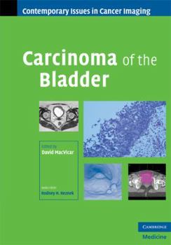 Carcinoma of the Bladder - Book  of the Contemporary Issues in Cancer Imaging