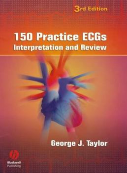 Spiral-bound 150 Practice Ecgs: Interpretation and Review Book