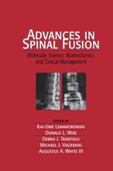 Hardcover Advances in Spinal Fusion: Molecular Science, BioMechanics, and Clinical Management Book