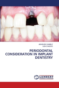 Paperback Periodontal Consideration in Implant Dentistry Book