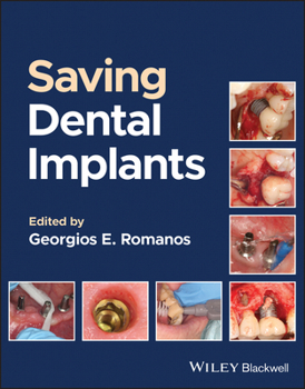 Hardcover Saving Dental Implants Book