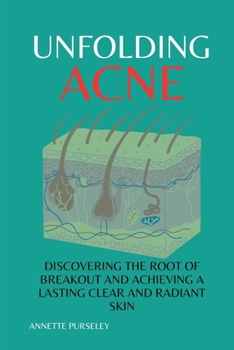 Unfolding Acne: Discovering The Root of Breakout and Achieving a Lasting Clear and Radiant Skin