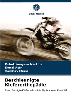 Paperback Beschleunigte Kieferorthopädie [German] Book