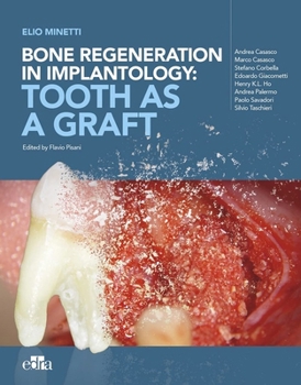 Hardcover Bone Regeneration in Implantology: Tooth as a Graft Book