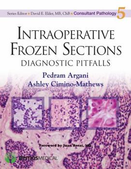 Hardcover Intraoperative Frozen Sections: Diagnostic Pitfalls Book