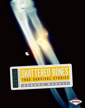 Library Binding Shattered Bones: True Survival Stories Book