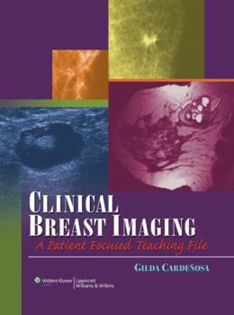 Hardcover Clinical Breast Imaging: A Patient Focused Teaching File Book