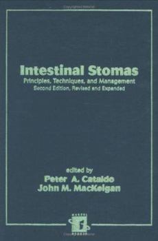 Hardcover Intestinal Stomas: Principles: Techniques, and Management Book