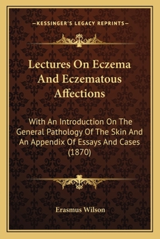 Paperback Lectures On Eczema And Eczematous Affections: With An Introduction On The General Pathology Of The Skin And An Appendix Of Essays And Cases (1870) Book