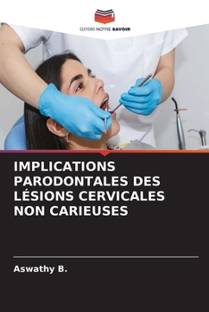 Implications Parodontales Des Lésions Cervicales Non Carieuses (French Edition)