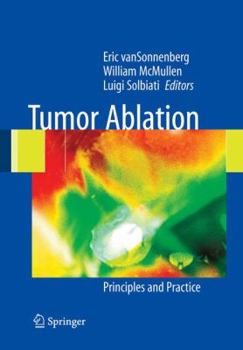 Hardcover Tumor Ablation: Principles and Practice Book