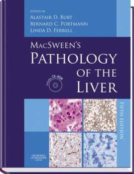 MacSween's Pathology of the Liver