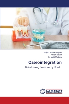 Paperback Osseointegration Book