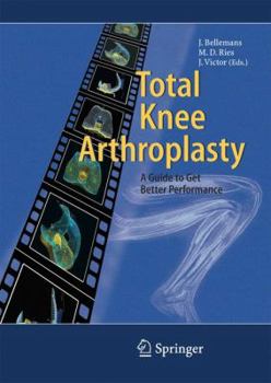 Hardcover Total Knee Arthroplasty: A Guide to Get Better Performance Book