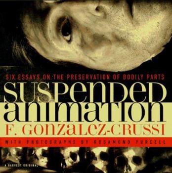 Paperback Suspended Animation: Six Essays on the Preservation of Bodily Parts Book