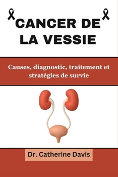 Paperback Cancer de la vessie: Causes, diagnostic, traitements et stratégies de survie [French] Book
