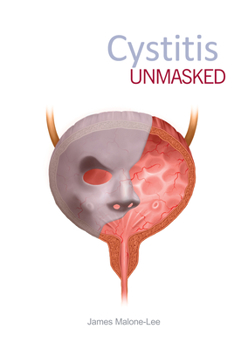 Paperback Cystitis Unmasked Book