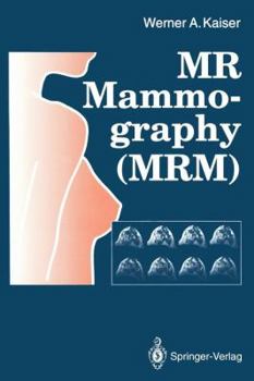 Paperback MR Mammography (Mrm) Book