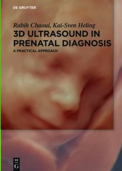 Hardcover 3D Ultrasound in Prenatal Diagnosis: A Practical Approach Book