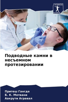 Paperback Подводные камни в несъем [Russian] Book