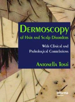 Hardcover Dermoscopy of Hair and Scalp Disorders: With Clinical and Pathological Correlations Book