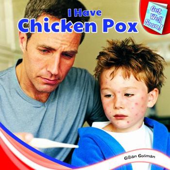 Library Binding I Have Chicken Pox Book